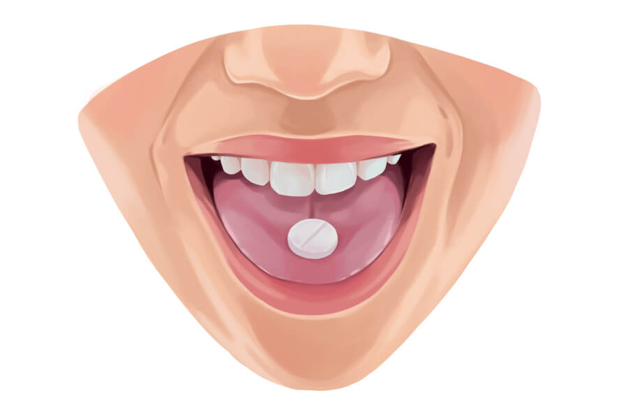 Oral conscious sedation prescription pill on a patient's tongue