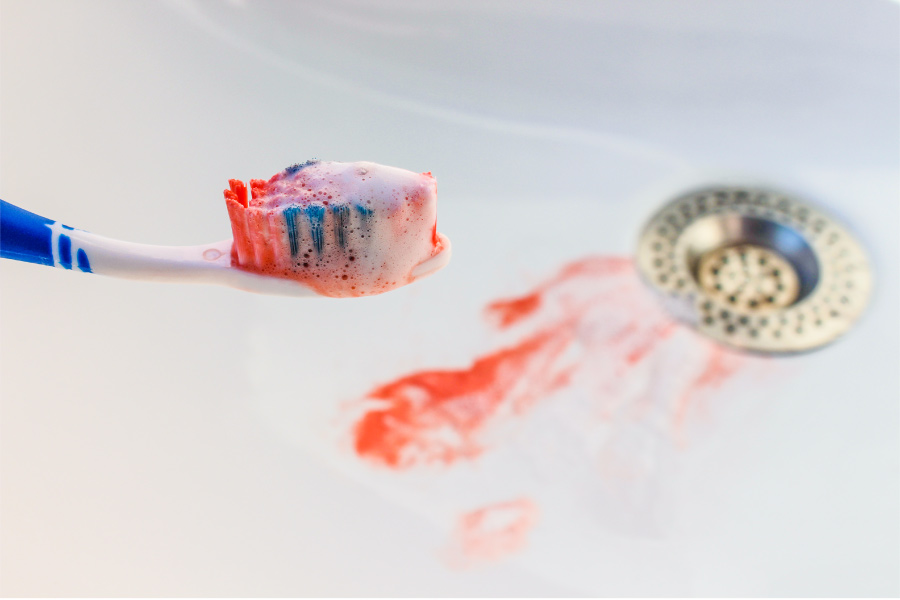Blood on a toothbrush and in the sink as a warning sign of gum disease