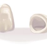 Illustration of 2 dental crowns to restore damaged teeth