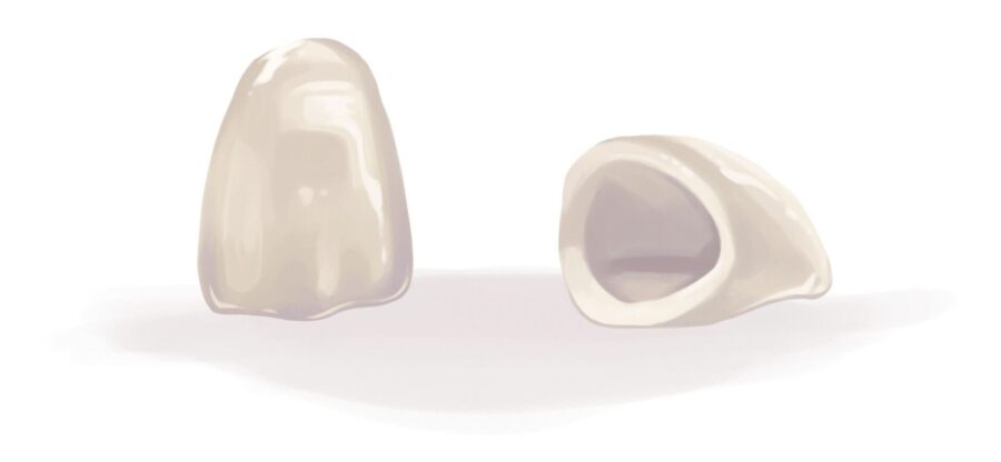 Illustration of 2 dental crowns to restore damaged teeth