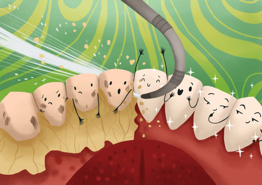 Illustration of a special dental tool removing plaque and tartar from around a row of teeth