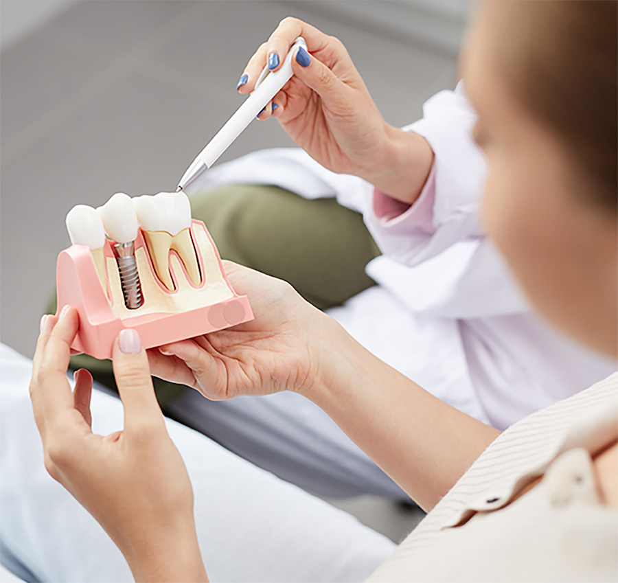 Photograph of patient education using a dental model during a dental implant consultation.